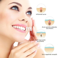 Toppa idrocolloide amichevole del brufolo dell'acne del vegano per la copertura Zits