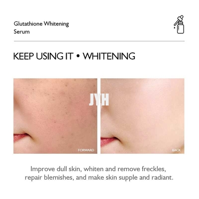 Glutatione che corregge il ODM del siero 30ml 1oz di ringiovanimento del fronte