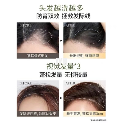 gel naturale della doccia dello sciampo organico del ODM 400ml per l'insieme di crescita dei capelli