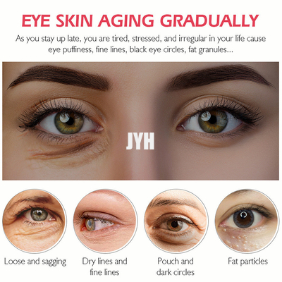 consolidamento della proteina dei cosmetici di Eyecare 20g e linee sottili d'alleggerimento che idratano la crema dell'occhio