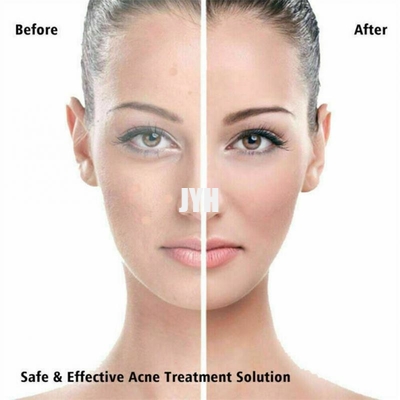 Toppa idrocolloide amichevole del brufolo dell'acne del vegano per la copertura Zits