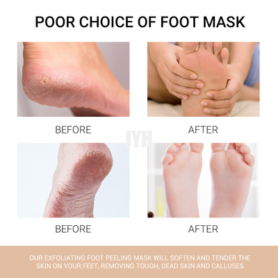 calzini esfoliare d'idratazione profondi di 40ml Juice Peach Foot Peel Mask